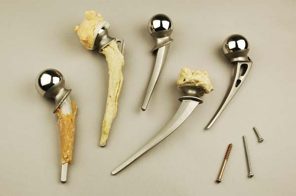 Prothese - Hüftgelenk