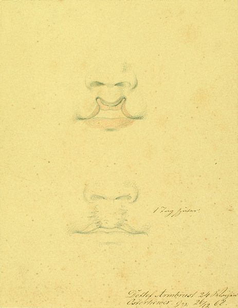 Krankenbildnis Detlef Armbrust